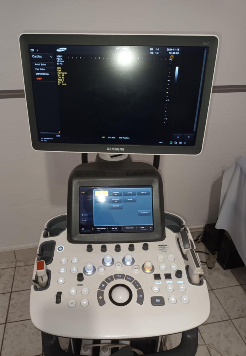 Samsung Medison H60 ultrahang készülék