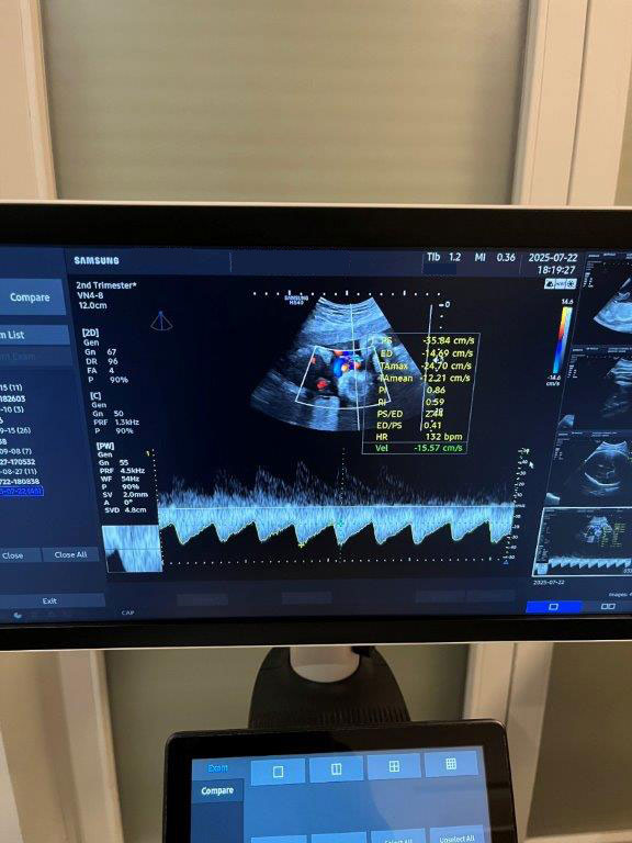 Használt HS40 ultrahang készülék négy vizsgálófejjel szülészeti, nőgyógyászati és radiológiai célra
