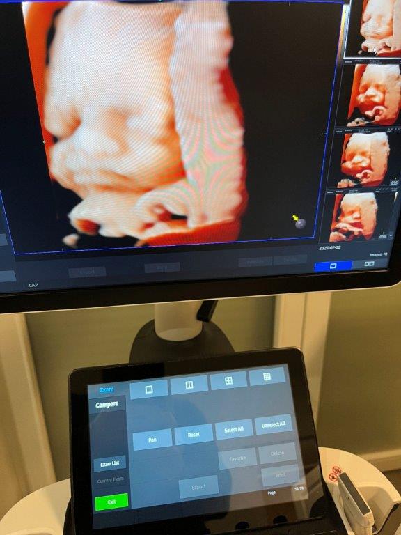 Használt HS40 ultrahang készülék négy vizsgálófejjel szülészeti, nőgyógyászati és radiológiai célra