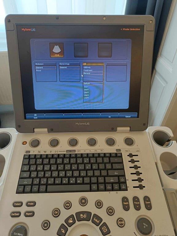 Samsung Medison MySonoU6 hordozható ultrahang készülék