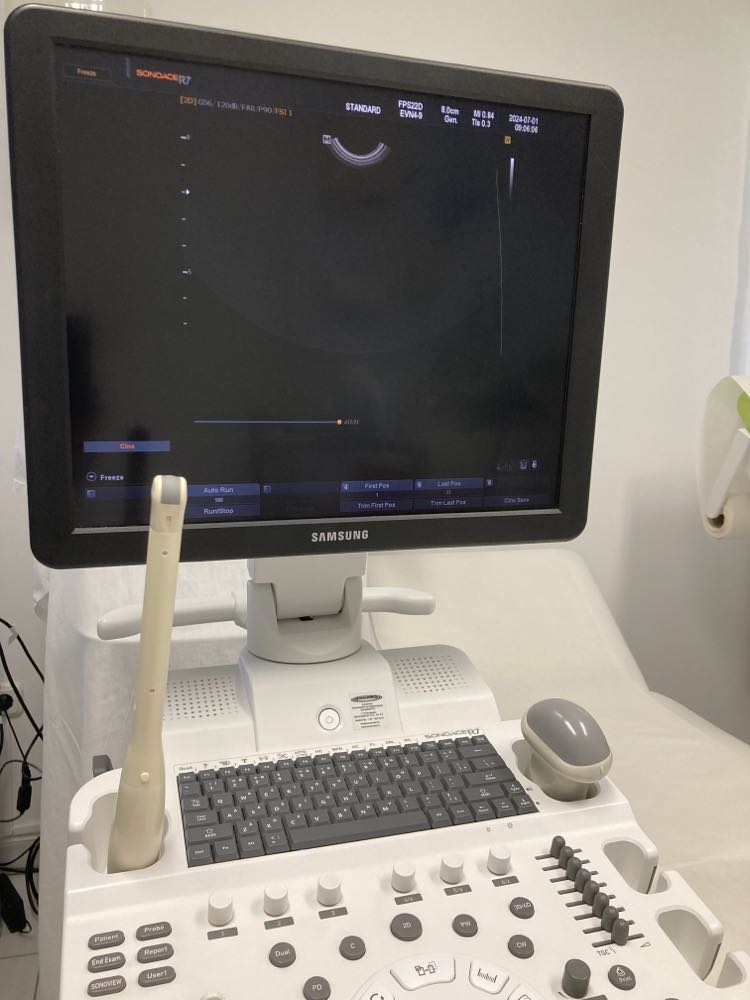 Használt SonoAce R7 szülészeti-nőgyógyászati ultrahang készülék